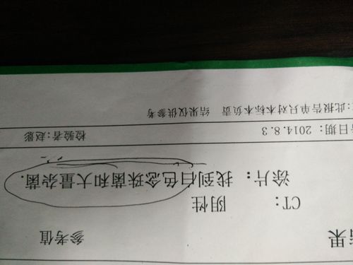 前几天在博爱医院查出来说有淋病,检查结果是白色念珠