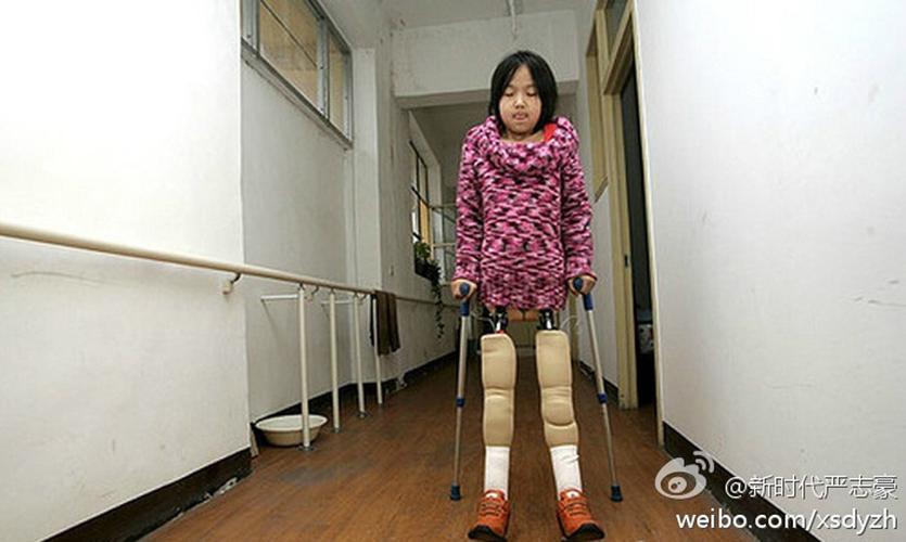钱红艳试着行走