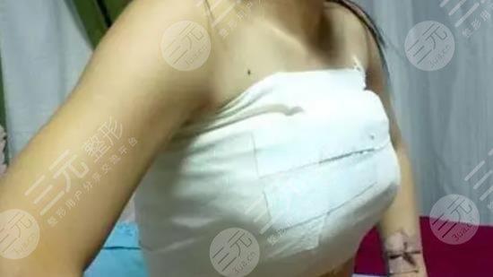 成都做隆胸医院排行榜清单来袭!这五家医院口碑如何?有案例哦