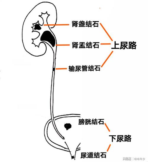首先,为了说明泌尿系结石的症状,就要先了解泌尿系统的形态.