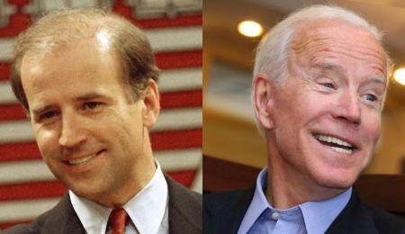 87年的拜登和植发后的拜登.图片来自美联社