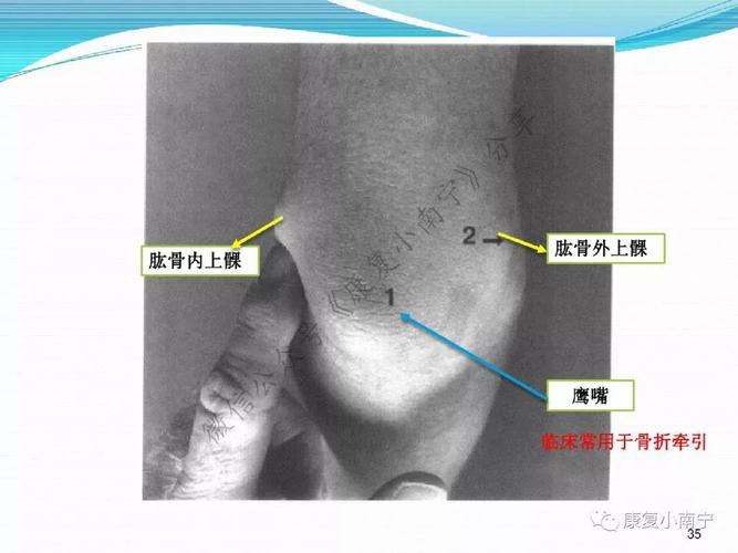 干货分享——上肢骨骼肌解剖及骨性标志(彩图)