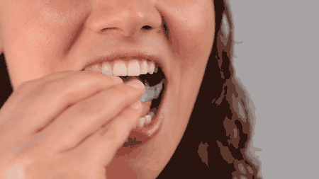 做了牙齿矫正到底会不会变美