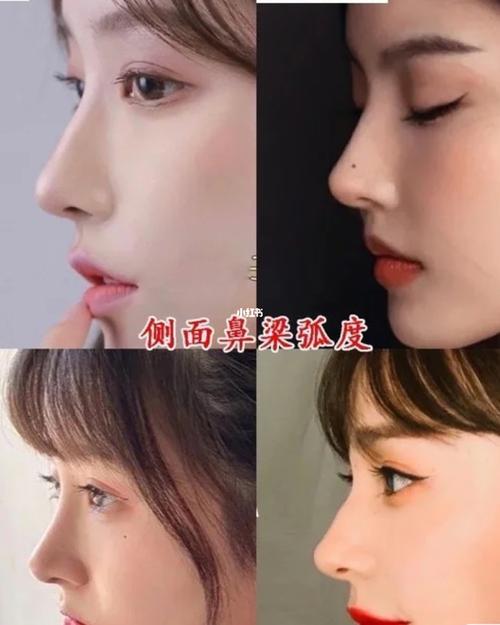 避坑小心机7815 2021年自然鼻6015几个条件做个好看的鼻子 一