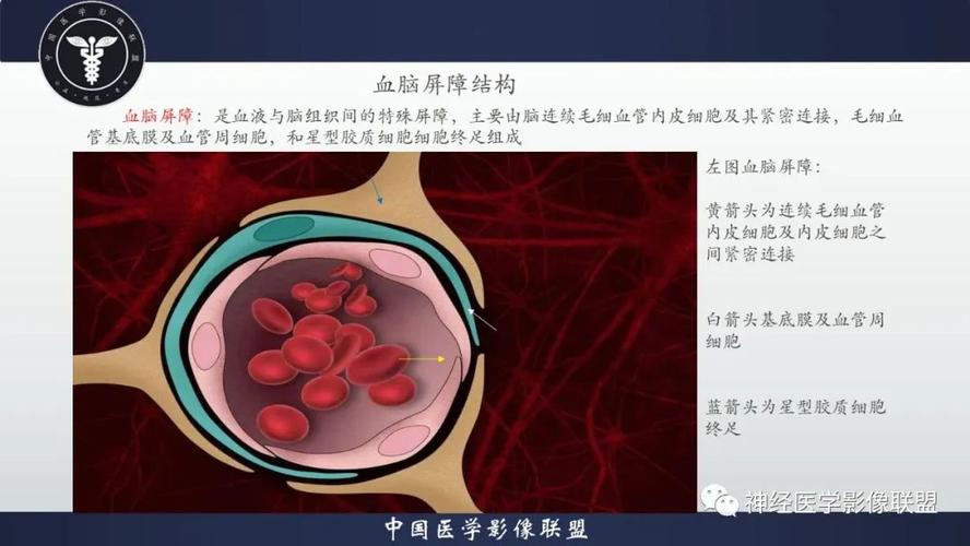 弥漫胶质瘤基础血脑屏障