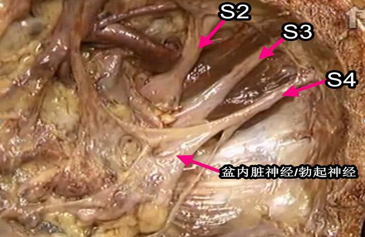 盆丛发出交感和副交感神经支配于末端结肠,盆腔内脏器和外生殖器.