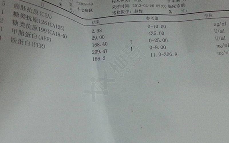 甲胎蛋白12.7正常吗?了解其正常值范围后你就知道了