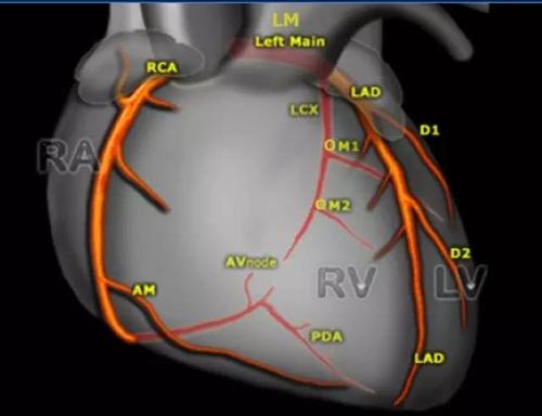 心脏解剖笔记:冠状动脉ct解剖及变异