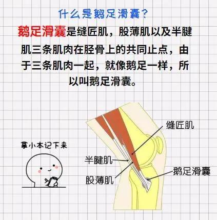 膝关节内侧痛?罗湖医院疼痛科:可能是鹅足滑囊炎惹的祸