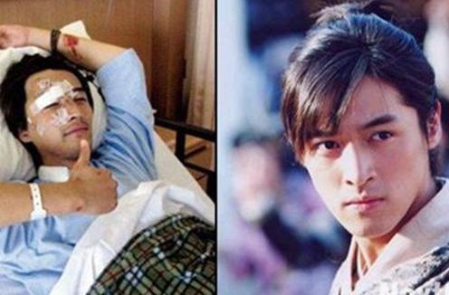 胡歌车祸前后照片曝光 面部受损严重无奈整容