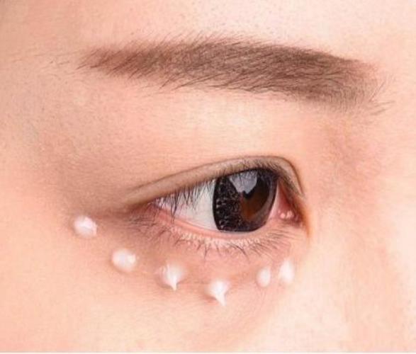 眼部皱纹分类(看看你的眼部细纹是哪种)