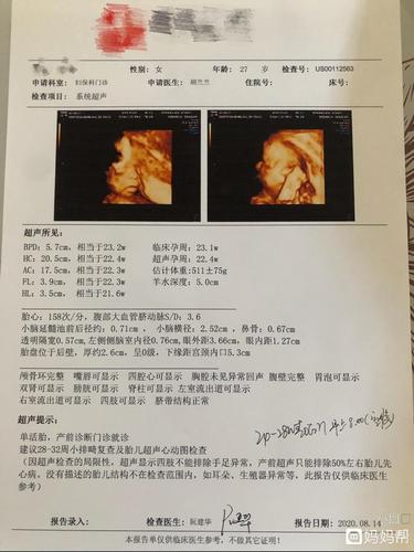 今天做的四维,怎么看男女呀,头胎男孩女孩