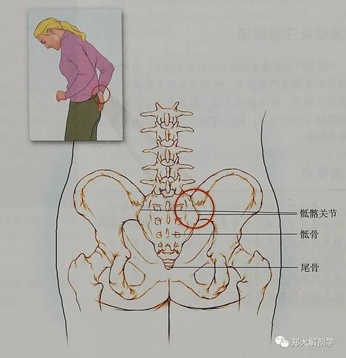 六种引起腰椎和骶髂关节的疼痛综合征
