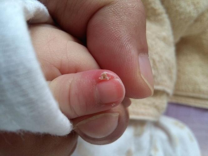 又有点像小痘痘,脂肪粒.请有经验的老师们给点帮助,谢谢!