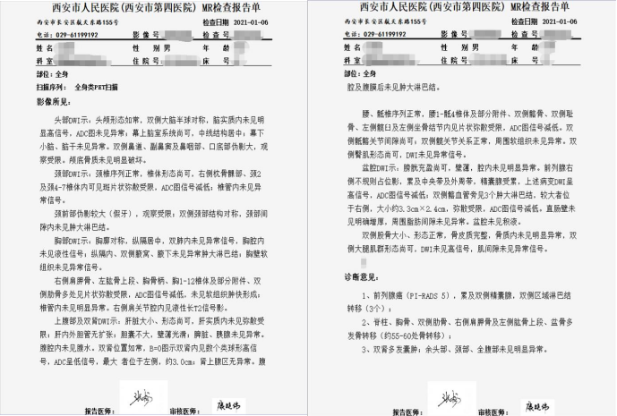 人民医院(西安市第四医院):航天城院区医学影像中心开展全身类pet检查