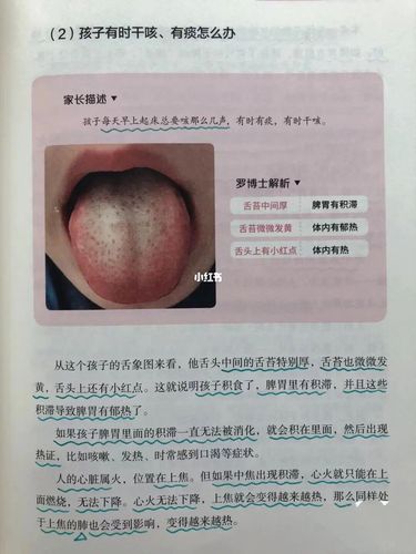 分享几张图片._积食_舌苔_咳嗽_肺炎_扁桃体