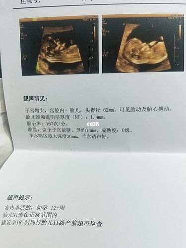 来接nt秒过啦_nt检查_女宝_女宝宝_接热乎乎的nt秒过