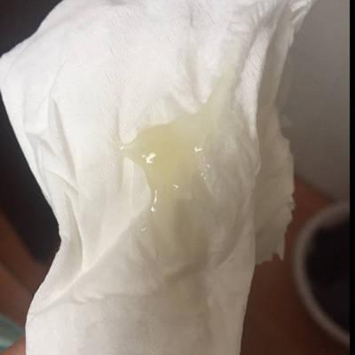 专家您好,现在孕394,已经连续四天流这样像果冻状的分泌物,这是宫颈