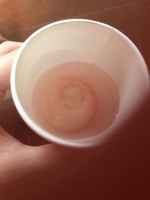 请问这是孕囊吗 药流过后排出的!