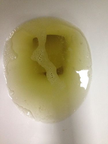 健康咨询描述:                      感觉小便沫子太多,便池里小小