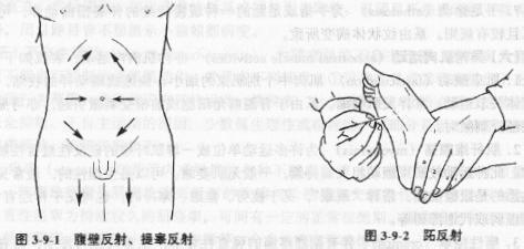 腹壁反射减弱或消失