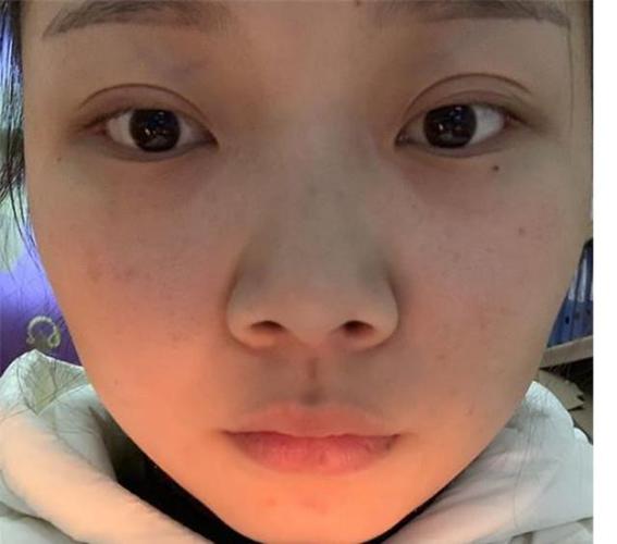朝天鼻的外形有点像猪鼻子,因此,拥有这种鼻子的女生在视觉上会给人