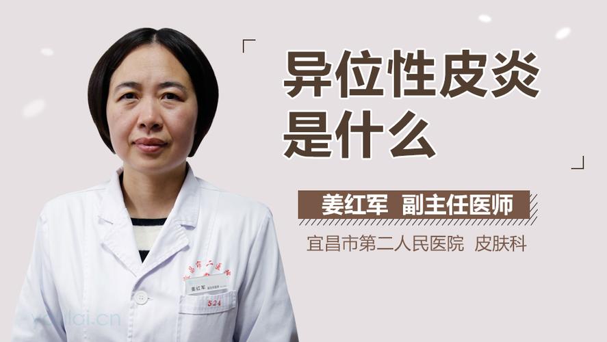异位性皮炎怎么治疗