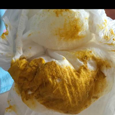 三个月宝宝,纯母乳拉这样不是拉肚子吧