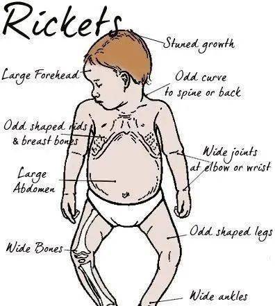 宝宝的头大,头小,偏头,方颅,是什么原因?一次性弄清楚