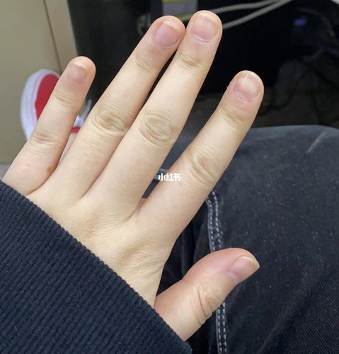 短甲床美甲前后对比_美甲_甲床_甲片_美妆_美甲