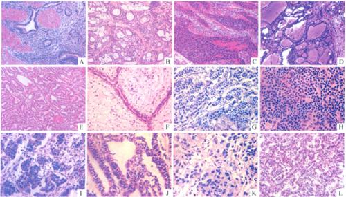 >>石蜡切片:常用于观察正常细胞组织的形态结构,是病理学用以研究