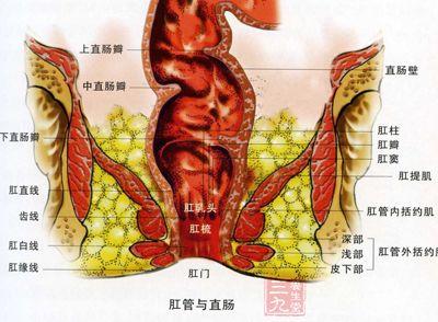 直肠炎是怎么引起的 直肠炎的症状与治疗