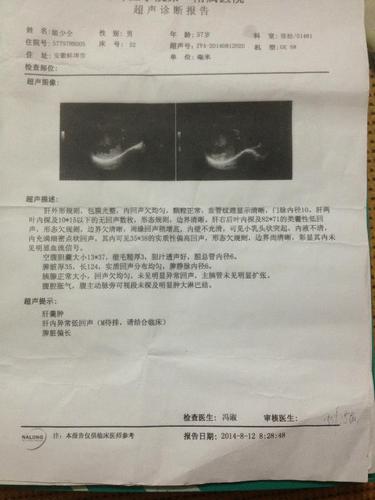 鼻咽癌伴肝转移,枕骨转移 有没有什么好的治疗方案?