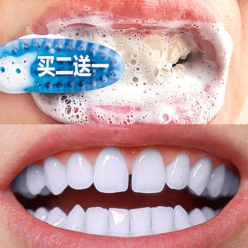 屈臣氐爆款洁牙慕斯泡沫牙膏牙齿变美美白神器牙齿