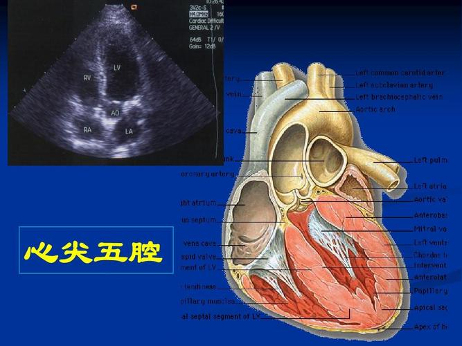 心脏超声诊断ppt