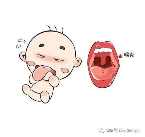 小儿急性喉炎——可危及生命的一种症状