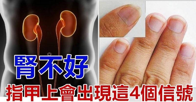 肾不好,指甲上会出现这4个信号,教你两招,养肾抗衰老.