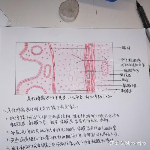 病理学红蓝铅笔手绘图