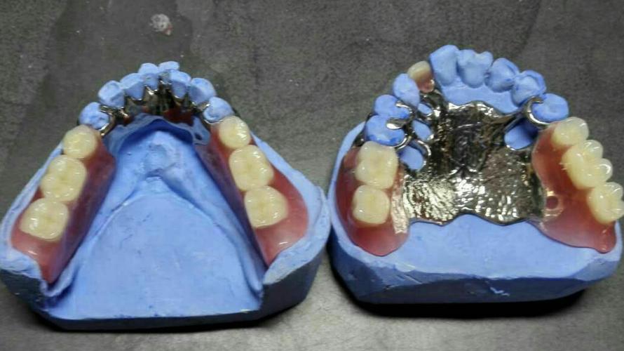 cad/ cam 纯钛支架(副本)