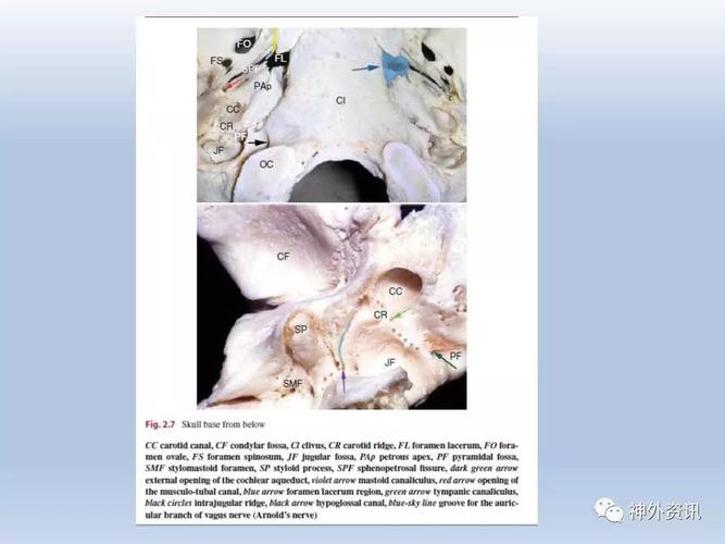 学习园地丨kawase三角与岩前入路经典文献(三)