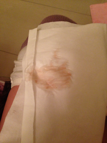 宝妈有流这样分泌物的吗?