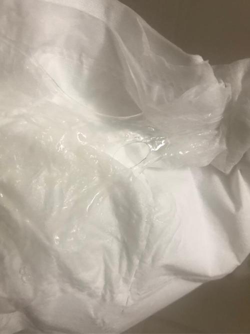 白带这样正常吗?