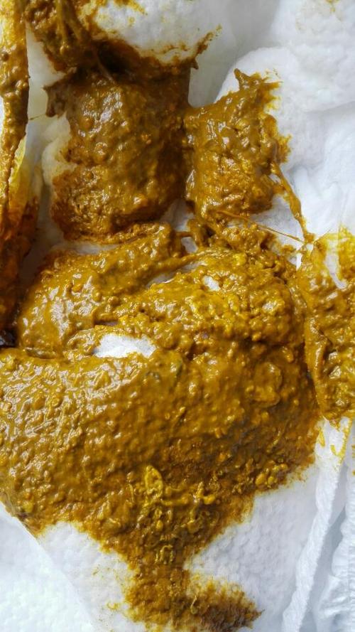 宝宝拉的大便有类似块状物,正常吗?