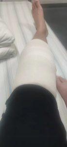 两年时间两次手术两段康复之路