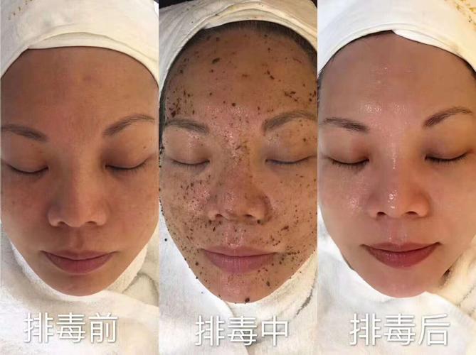 皮肤粗糙面部排毒怎样操作_广东具有口碑的面部清洁面部排毒