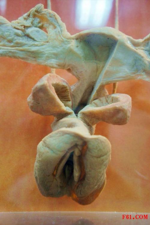 女性生殖(阴道,子宫,输卵管,卵巢)实体解剖图