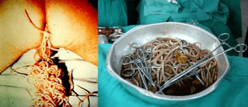 的第十三站,给大家介绍生活中最常见的肠道寄生虫之一--蛔虫