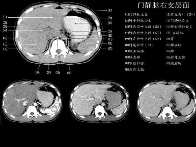 正常肝脏ct解剖ppt