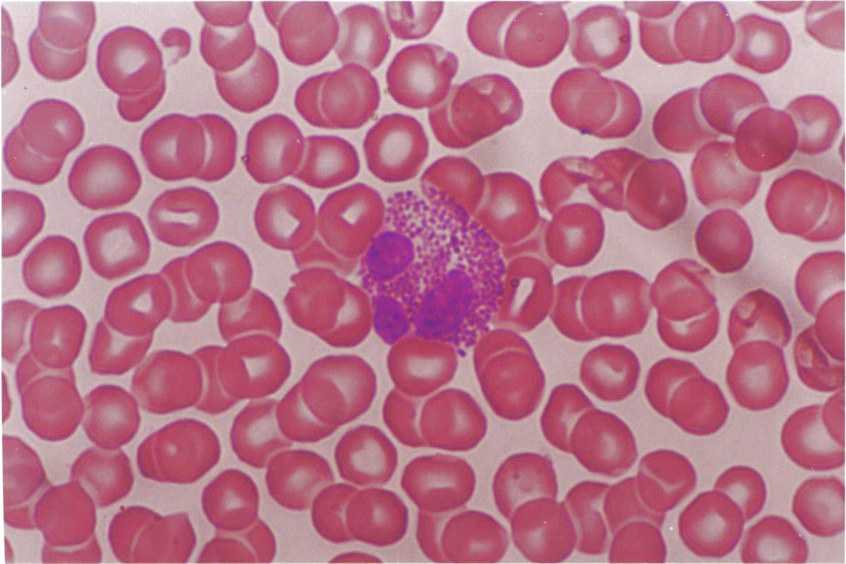 嗜碱性粒细胞计数