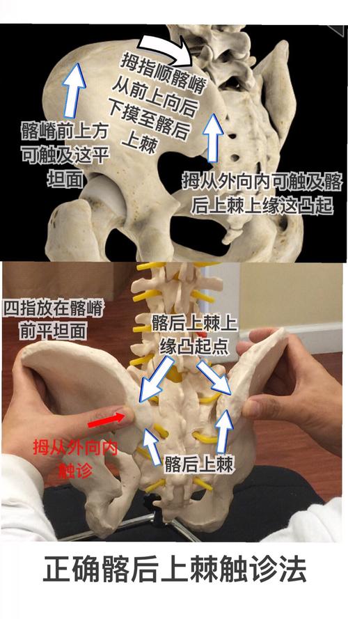 骶骨错位在临床上的意义与治疗(三)